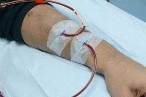 Dialysis